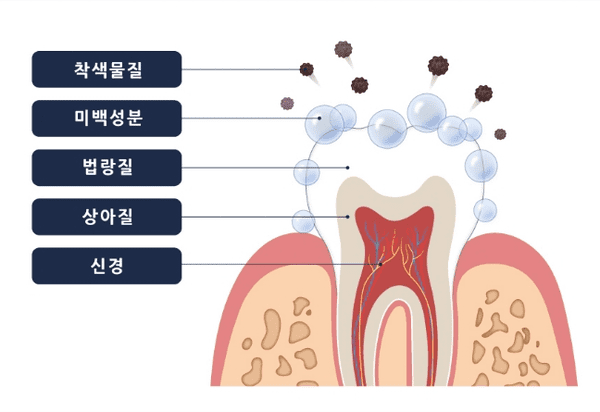 치아미백이 진행되는 과정