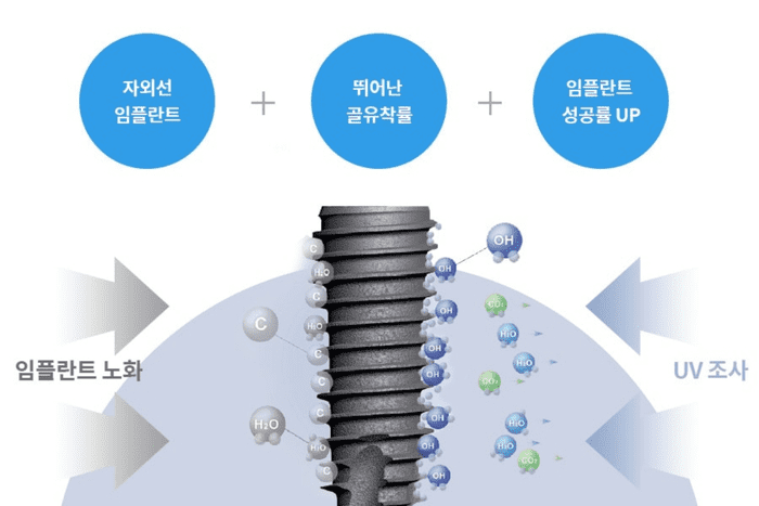 임플란트 고정체의 표면 처리 기술